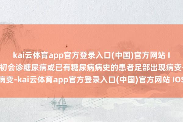 kai云体育app官方登录入口(中国)官方网站 IOS/安卓通用版/手机版 初会诊糖尿病或已有糖尿病病史的患者足部出现病变-kai云体育app官方登录入口(中国)官方网站 IOS/安卓通用版/手机版